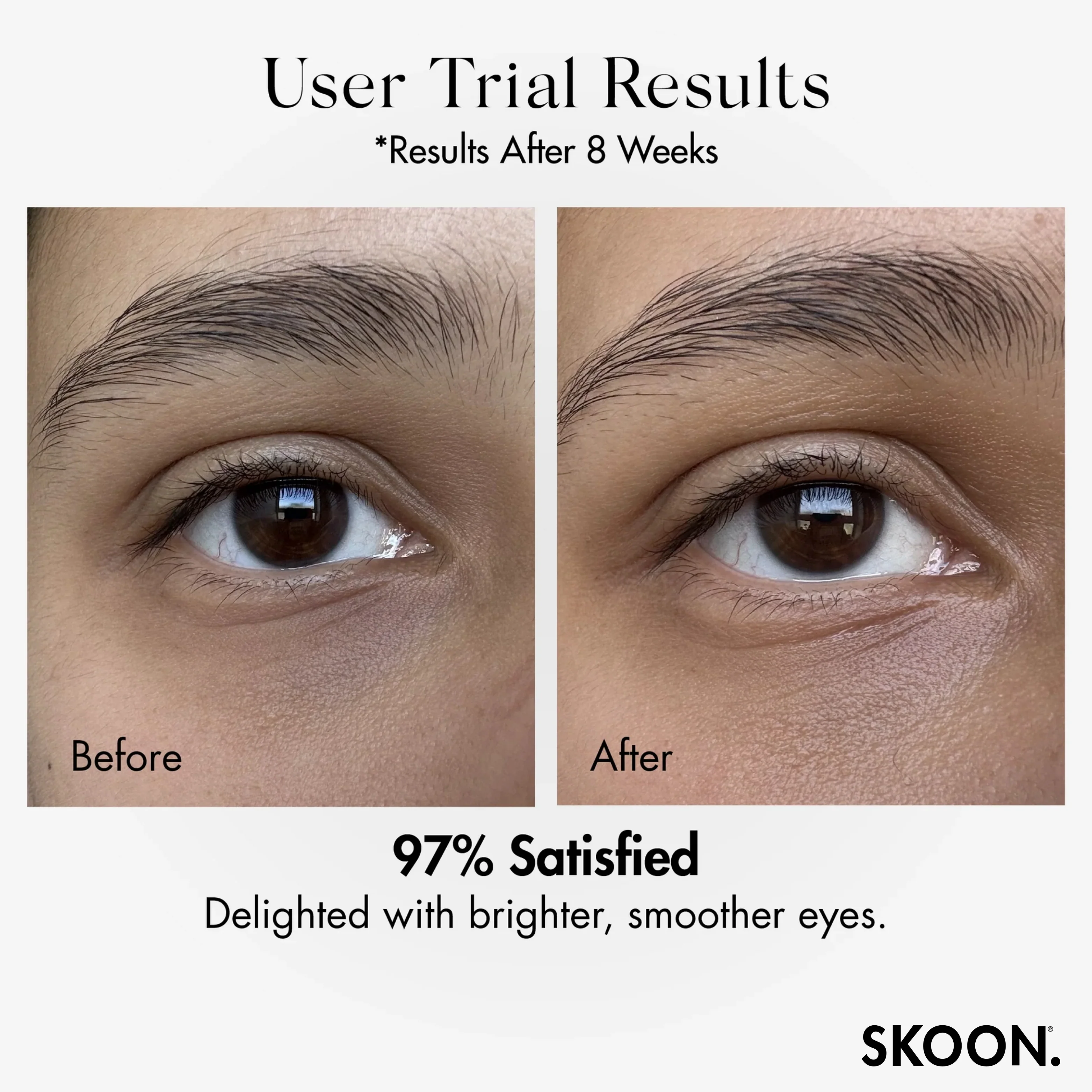 SKOON - Bright-Eyed Brighten + Firm Eye Cream 15ml - Image 3
