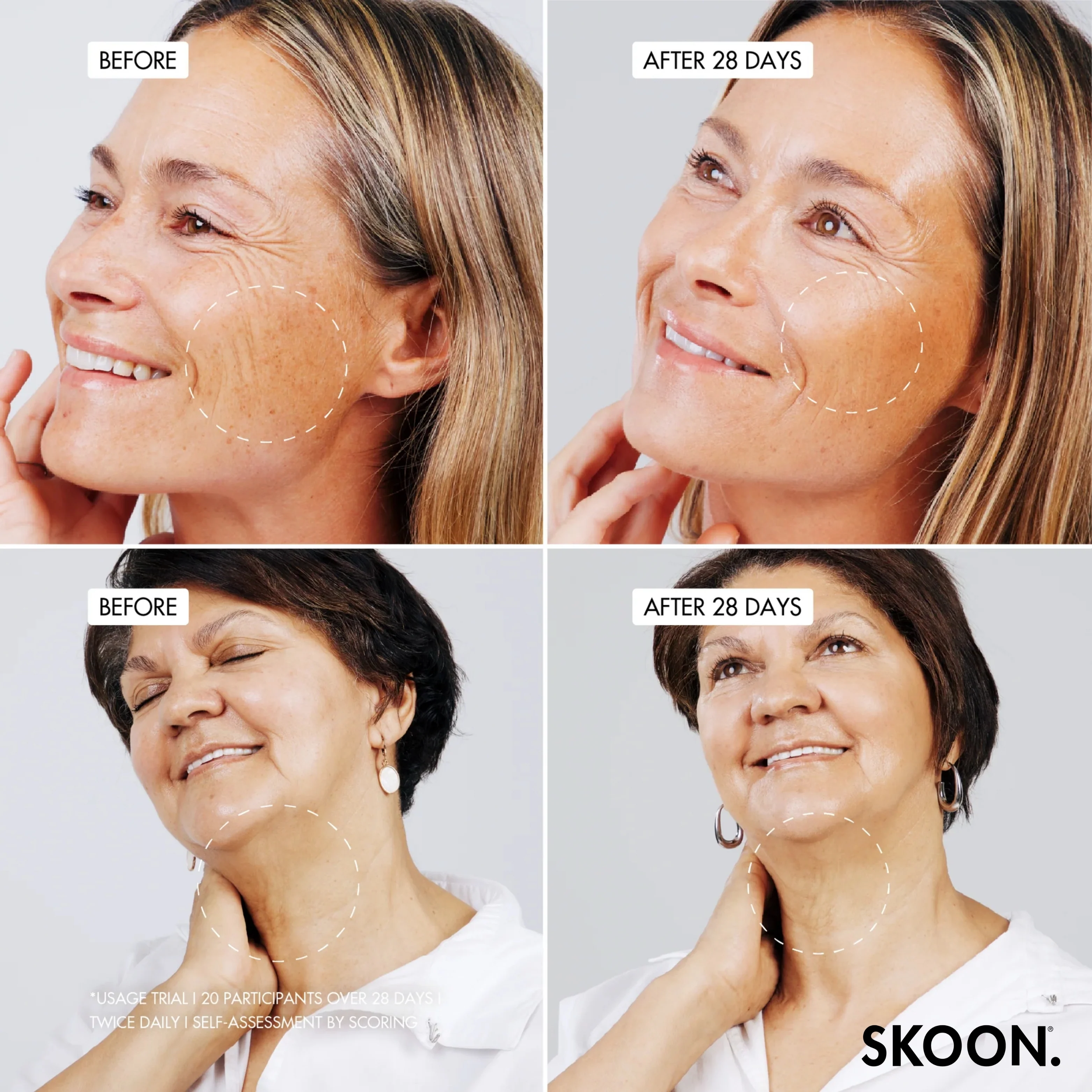 SKOON - Rosegold Deep Tissue Concentrate 15ml - Image 3
