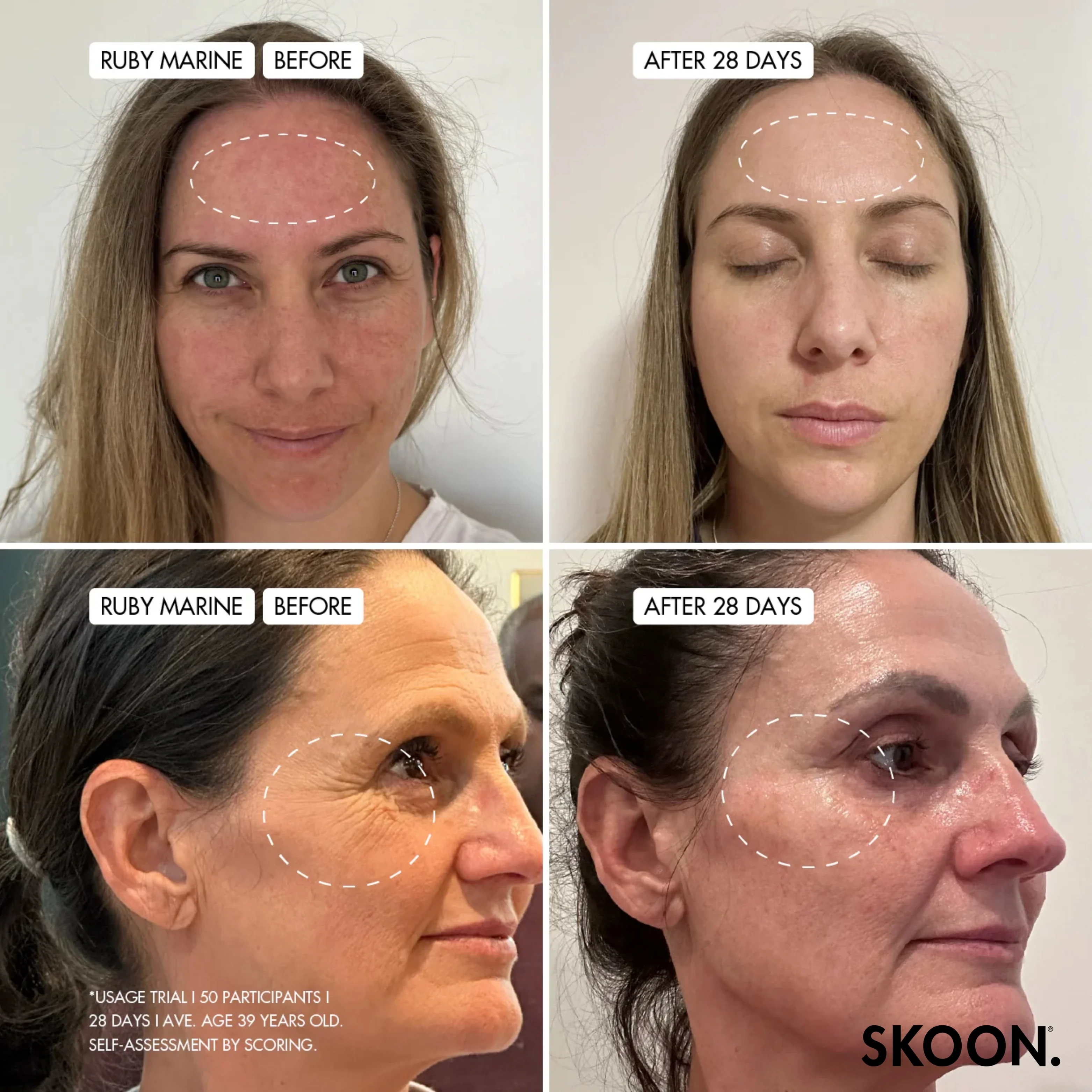 SKOON - Tame The Zone Combination ( Oily T) + Sensitive Skin Set - Image 4