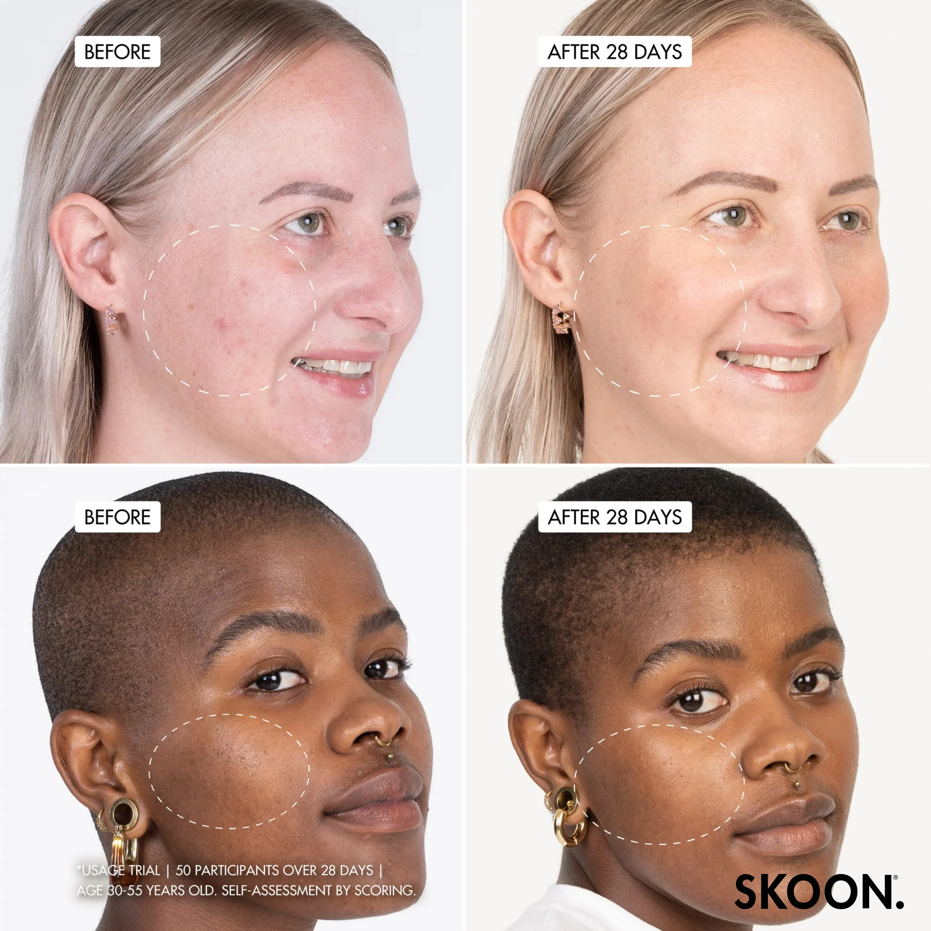 SKOON - Wow Wow Wonder + Nanopillow Serum 30g - Image 2